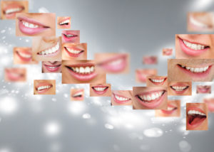 Отбеливание зубов zoom 3