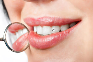 Здоровье зубов и иммунитет